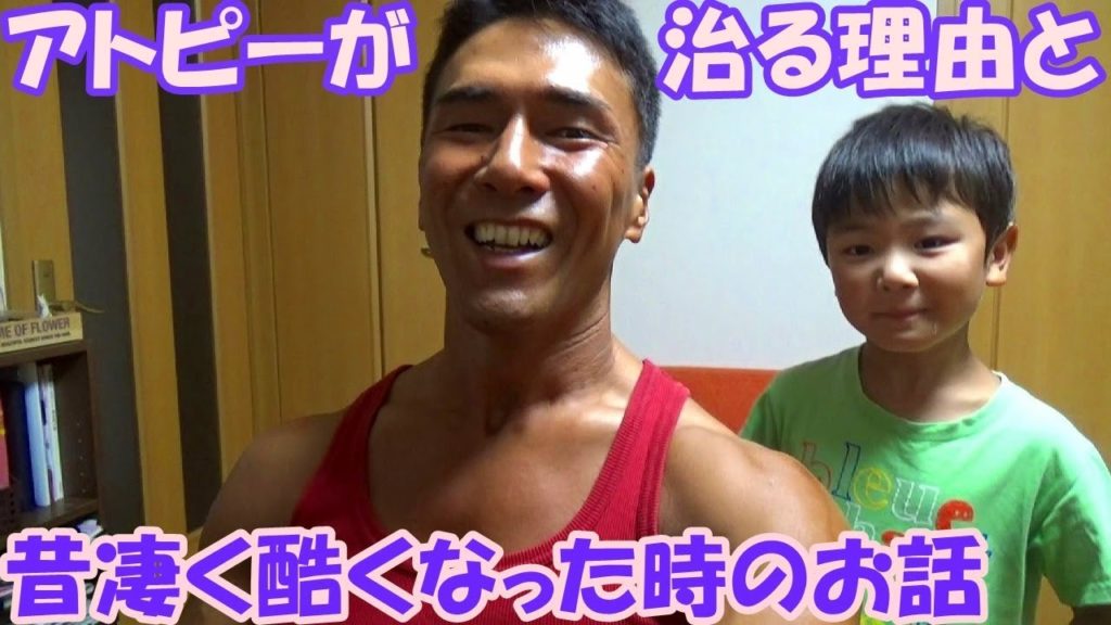 僕のアトピーはボディビルの減量中綺麗に治ります【雑談動画